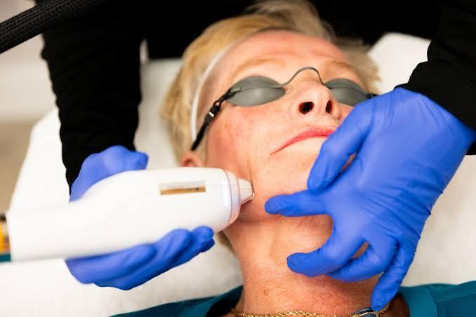 Illustrative laser skin treatment scene