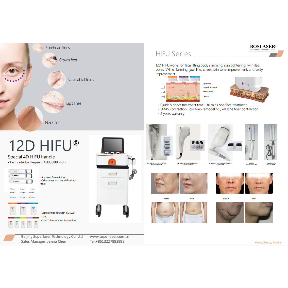 Aurora-PHF711 Professional Facial Platform product detail 2